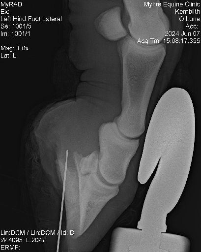 Luna Radiographs0006